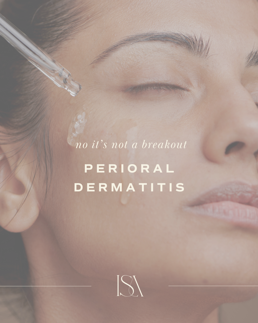 Why is everyone getting perioral dermatitis?