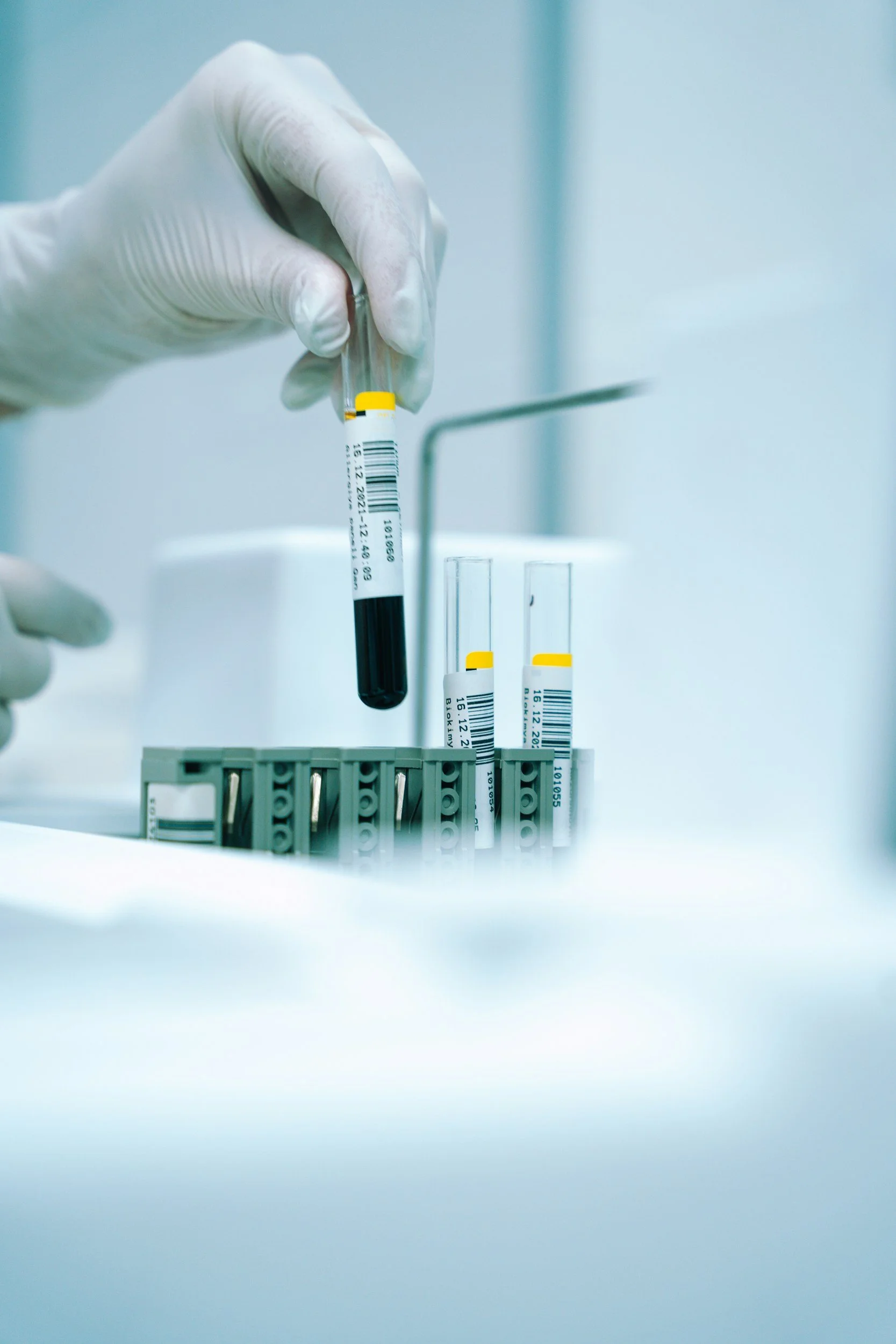 New blood-based risk score for lung cancer prevention