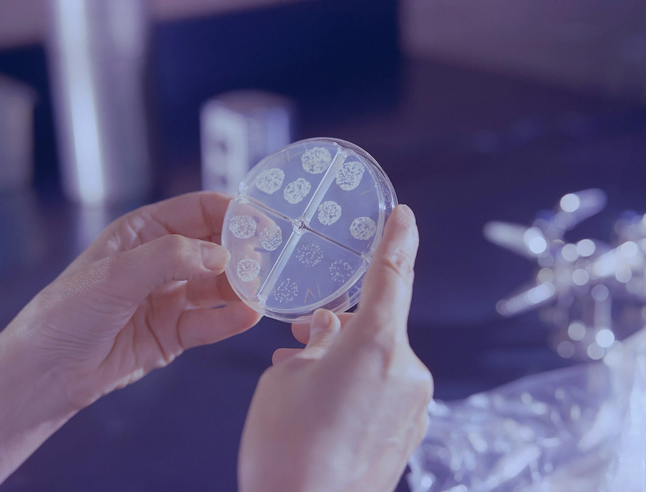 What to know about the growing Cyclospora outbreak