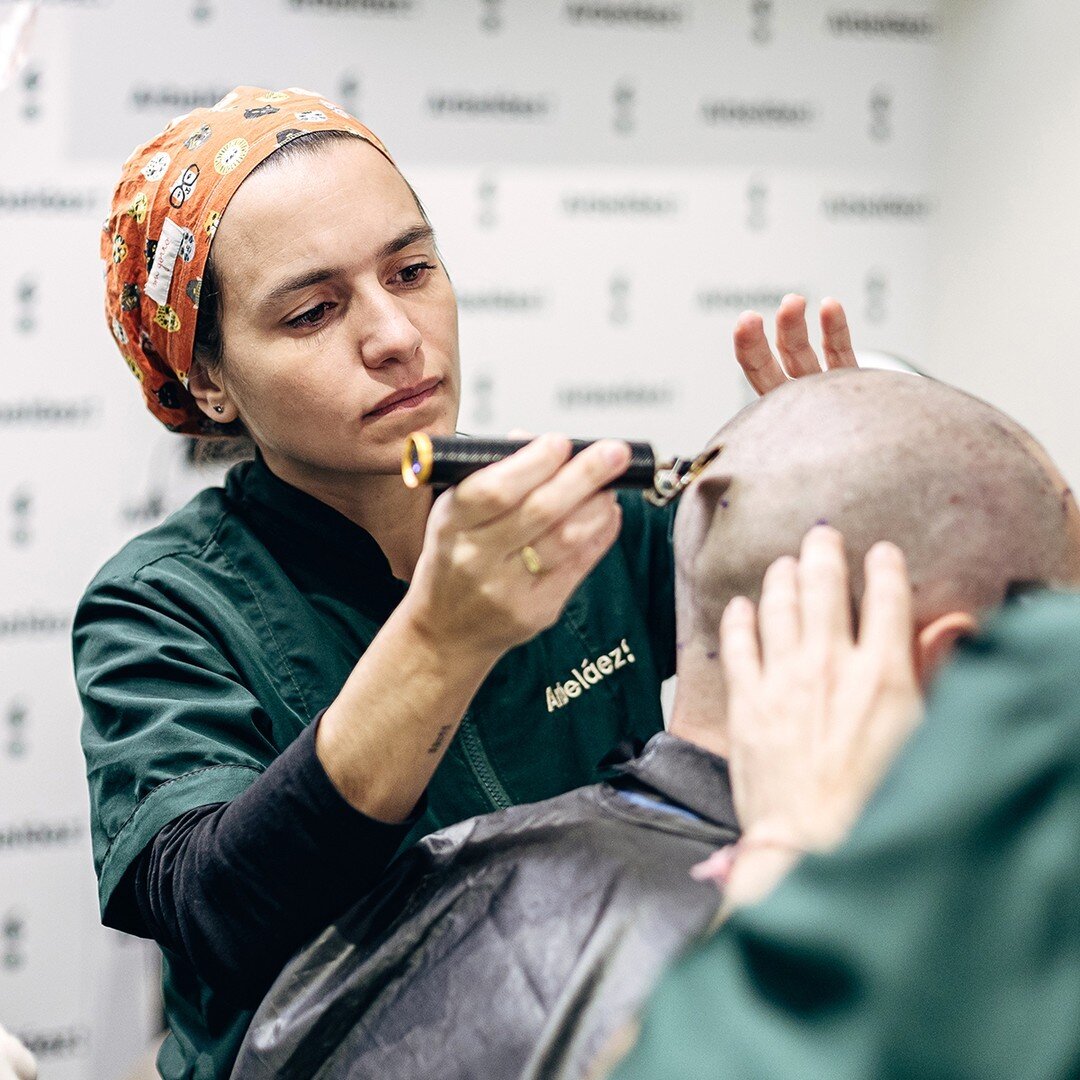 🧔 Un injerto capilar es una opci&oacute;n popular para tratar la alopecia com&uacute;n o androgen&eacute;tica, entre otras, y en nuestra consulta, aprender a cuidar tu cabello es fundamental.

👨⚕ Realizaremos un seguimiento durante un a&ntilde;o pa