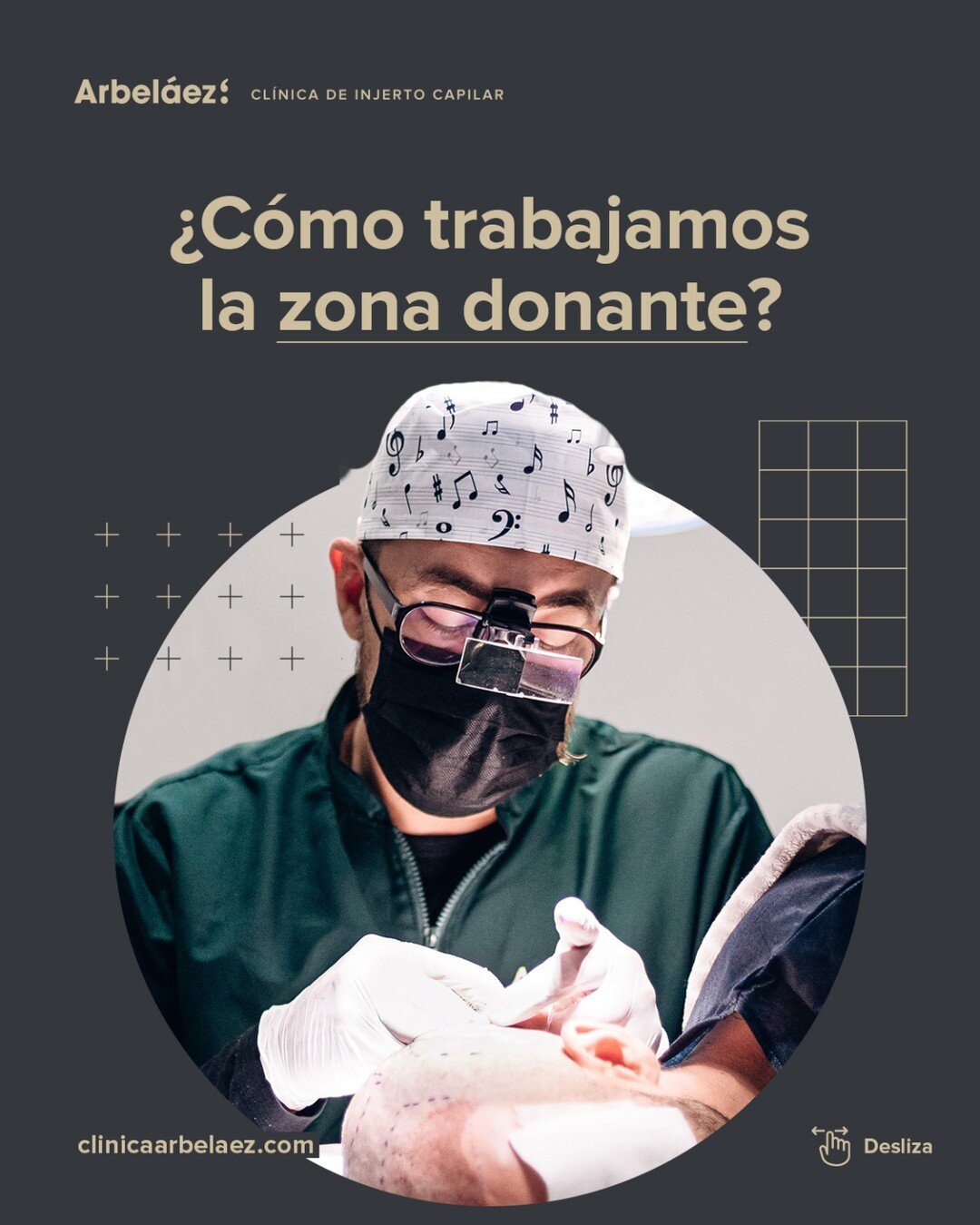 ✍️ Descubre nuestro proceso para trabajar la zona donante en la Cl&iacute;nica Arbel&aacute;ez.

👨⚕ Es un procedimiento meticuloso y cuidadoso. La zona donante es tan importante como la zona receptora en cualquier intervenci&oacute;n de cirug&iacute