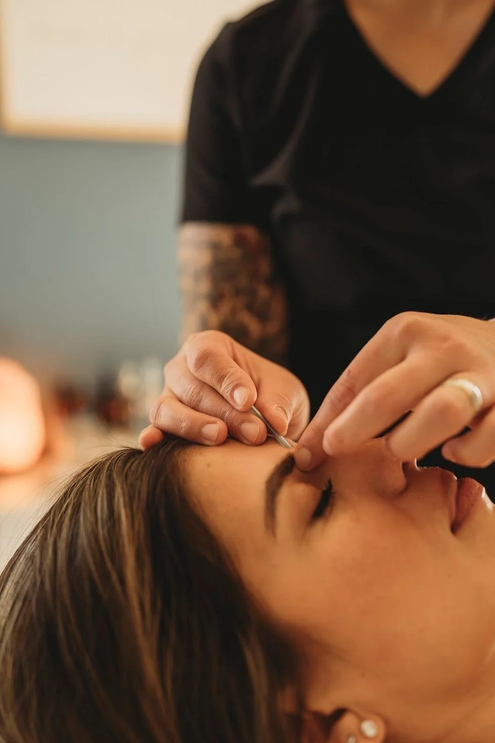 acupuncturist in Corning NY applying acupuncture needles to patients face