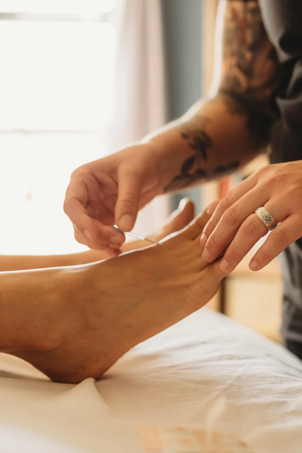acupuncturist in corning NY applying acupuncture needles to a patients feet
