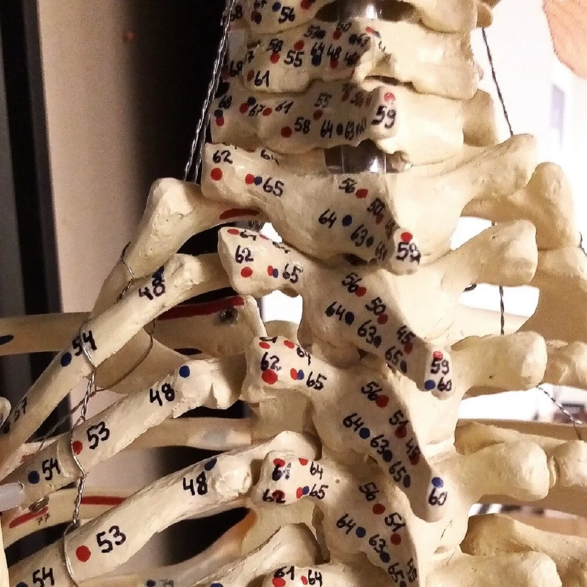 Die am häufigsten auftretenden akuten Schmerzen, die von der Wirbelsäule ausgehen, sind auf Veränderungen der Bandscheibe zurückzuführen