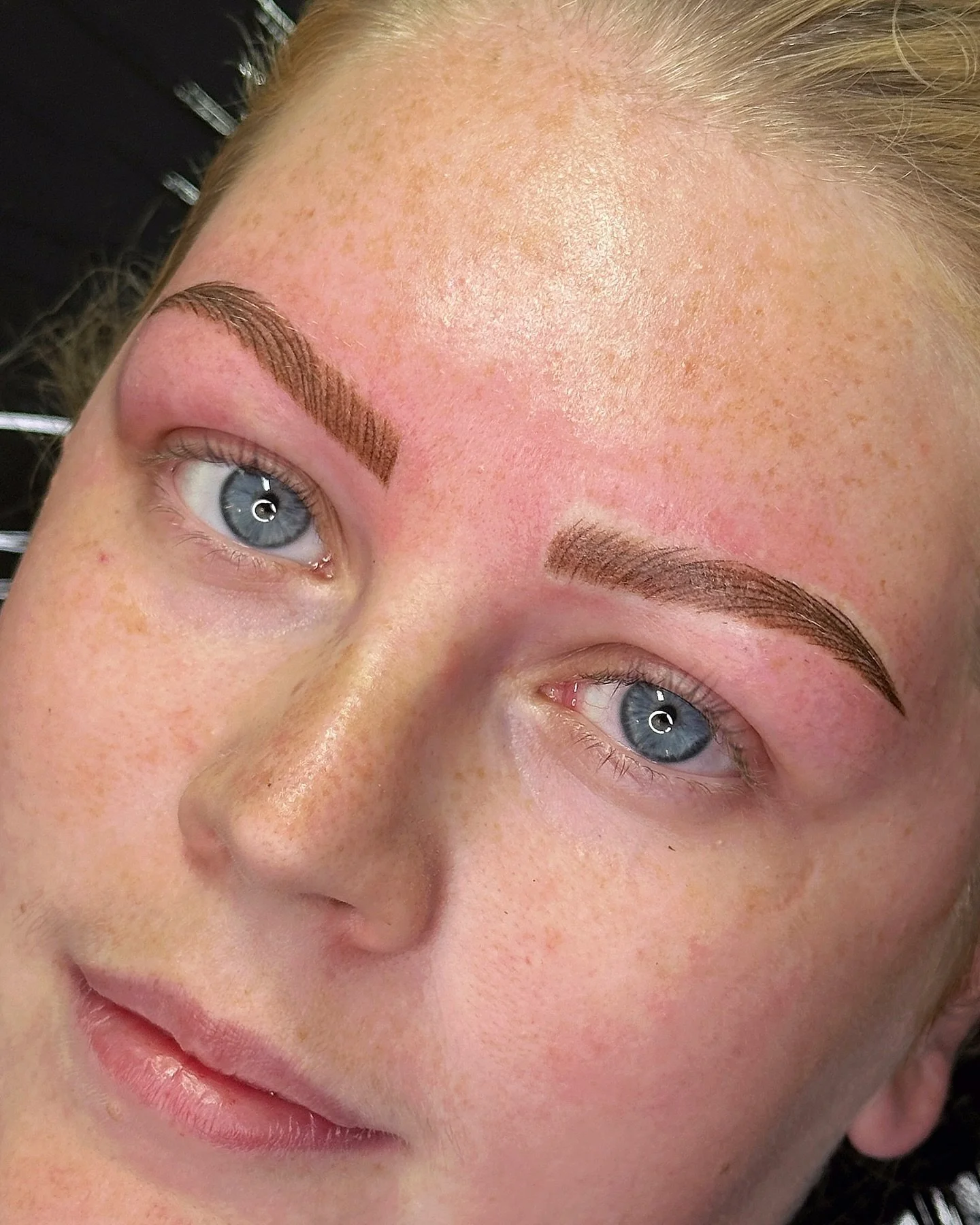 Hyperealism brows ✨
This lovely client came to me with old microblading from another artist &mdash; the base had healed with a red undertone and compromised skin.

I used a 3RL and thinning solution to create a soft colour wash to neutralise the red,