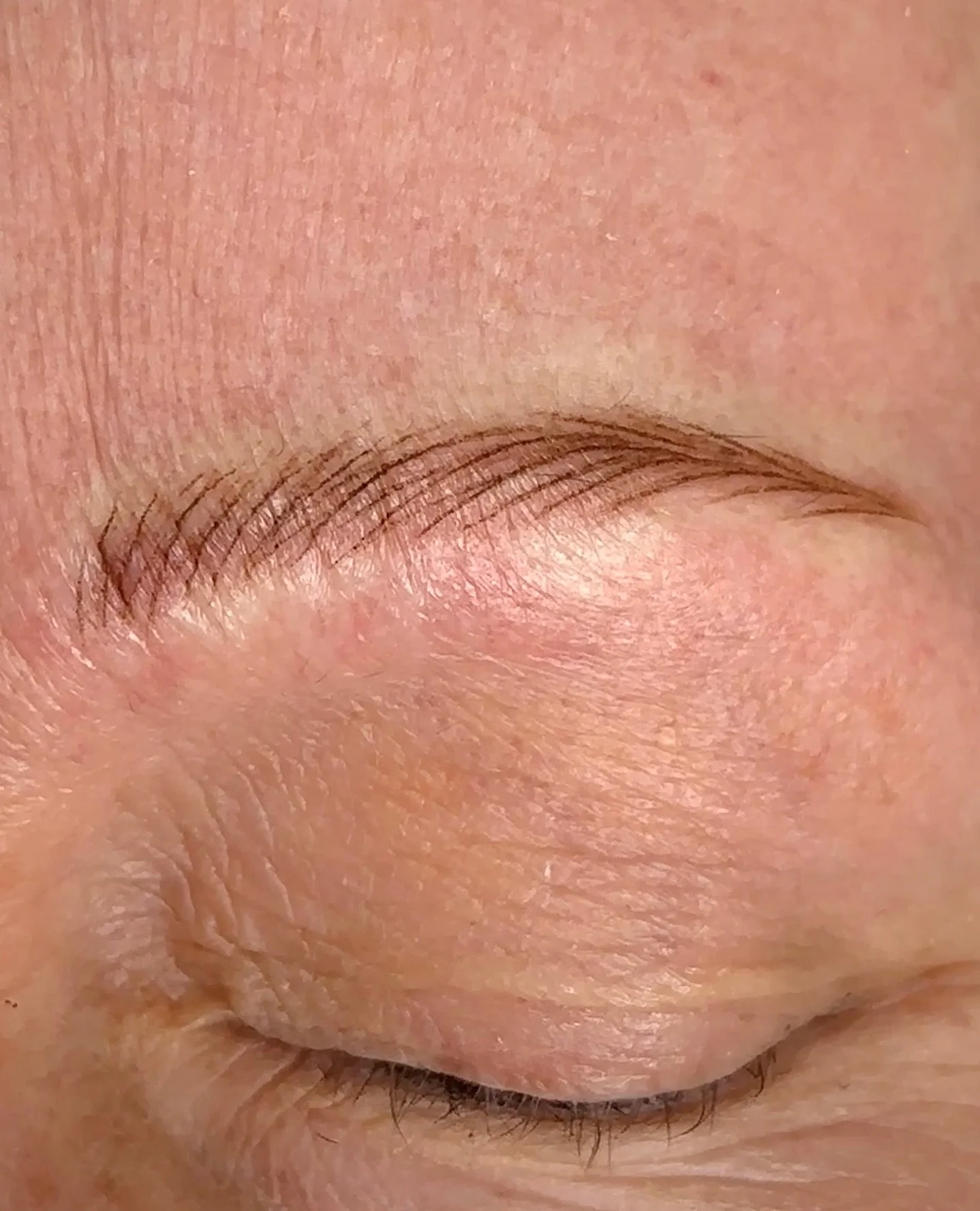 Client Journey Update
When she first came to me, her brows had been through a lot&mdash;old pigment from previous microblading sessions had left behind scarring and a warm undertone, with no visible hairstrokes. Unfortunately, repeated top-ups on com