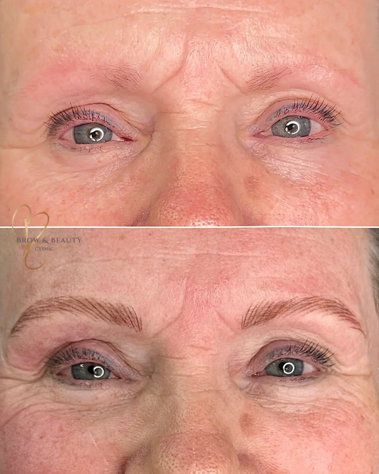 First session of nano Brows for this lovely client making her morning makeup routine a breeze 😌 these will settle and fade up to 30% during the healing process ☁️

#NanoBrows #HyperRealismBrows #BrowTransformation #PMUChester #NaturalLookingBrows
