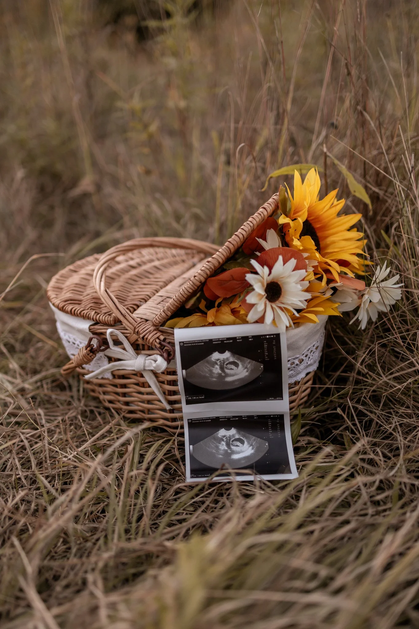 A picnic basket filled with sunflowers and daisies, with ultrasound images placed in front, set on dry grass in a natural outdoor setting.