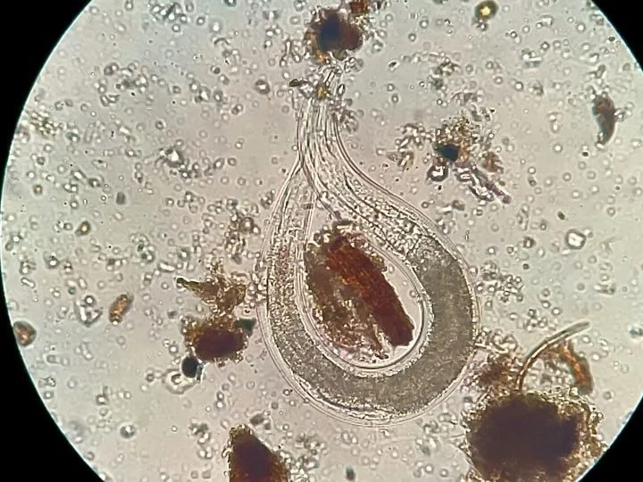 Soil sample collection with the students @murrumbeena.primary.school and later viewing of the tiny critters of the #soilfoodweb under the microscope.