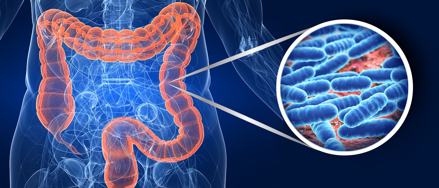 5 Types Of Foods To Improve Your Gut