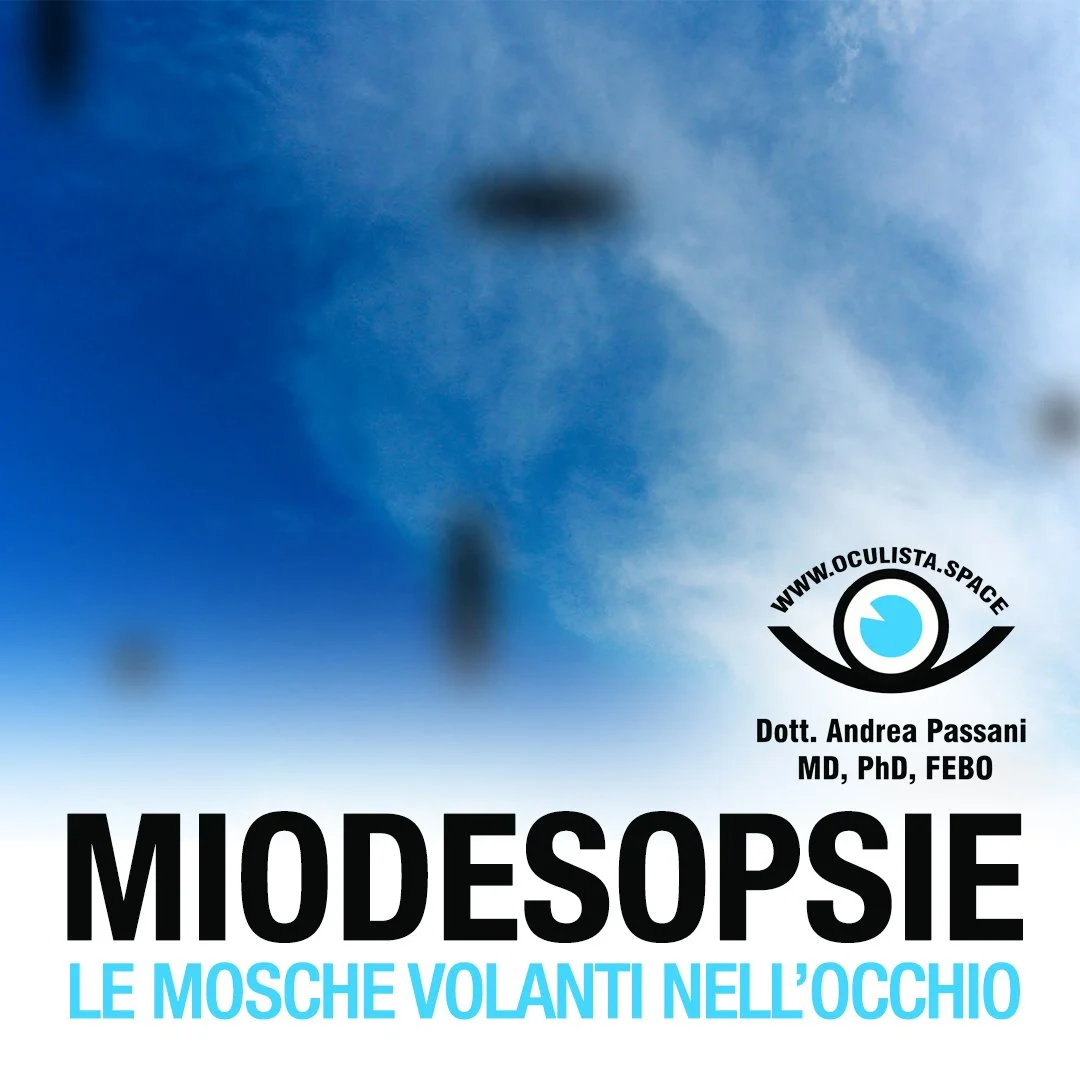 Miodesopsie: le mosche volanti dell'occhio