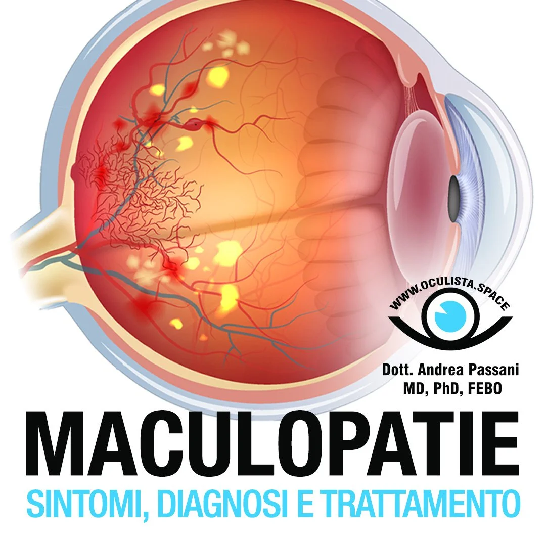 Maculopatie: sintomi, diagnosi e trattamento