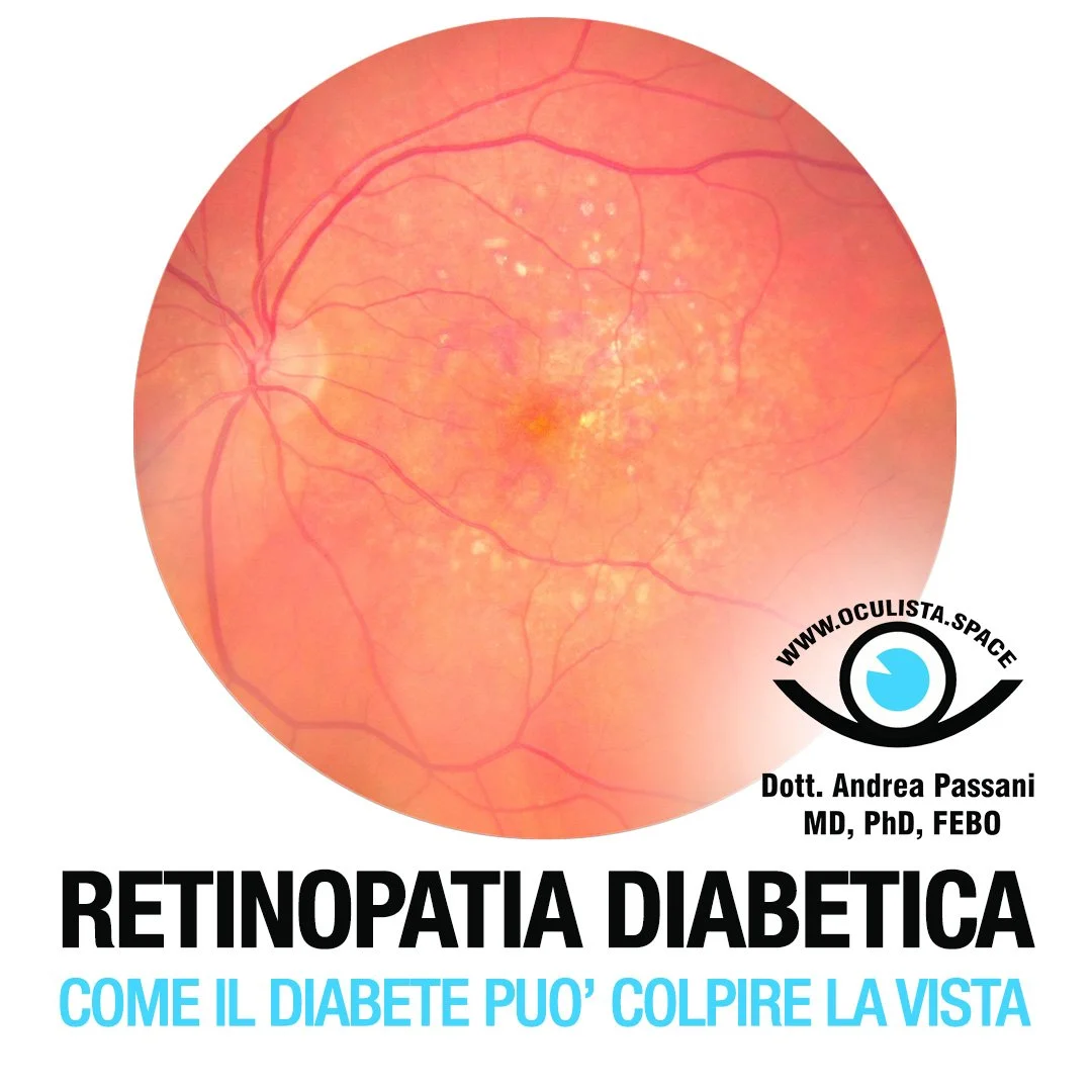 La retinopatia diabetica