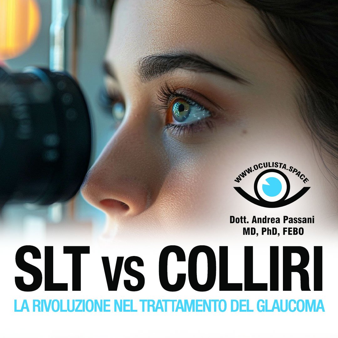 SLT vs. Colliri Ipotonizzanti: Una Nuova Visione nel Trattamento del Glaucoma