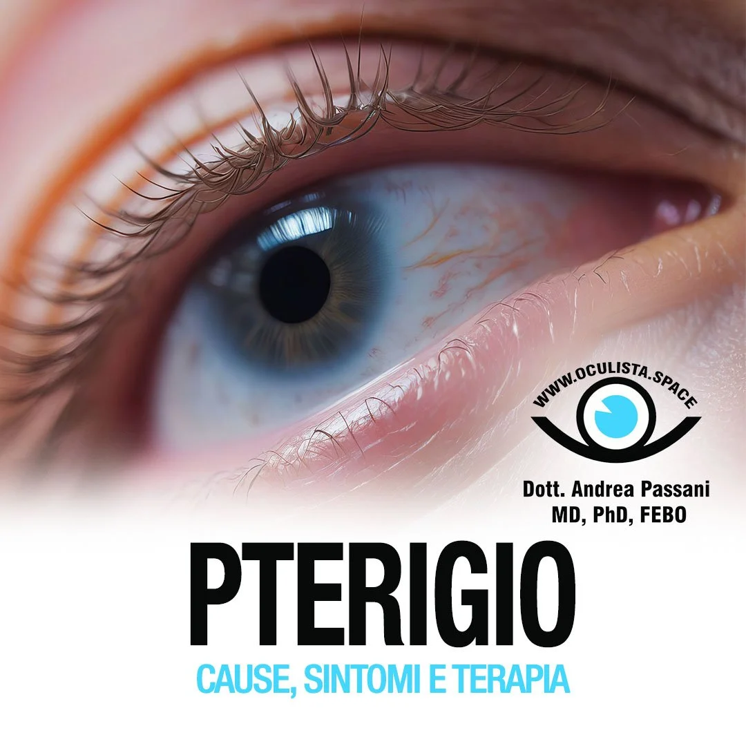 Pterigio: cause, sintomi e trattamento