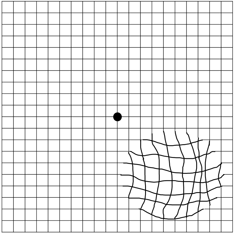 metamorfopsie-in-test-di-amsler-andrera-passani-oculista.png