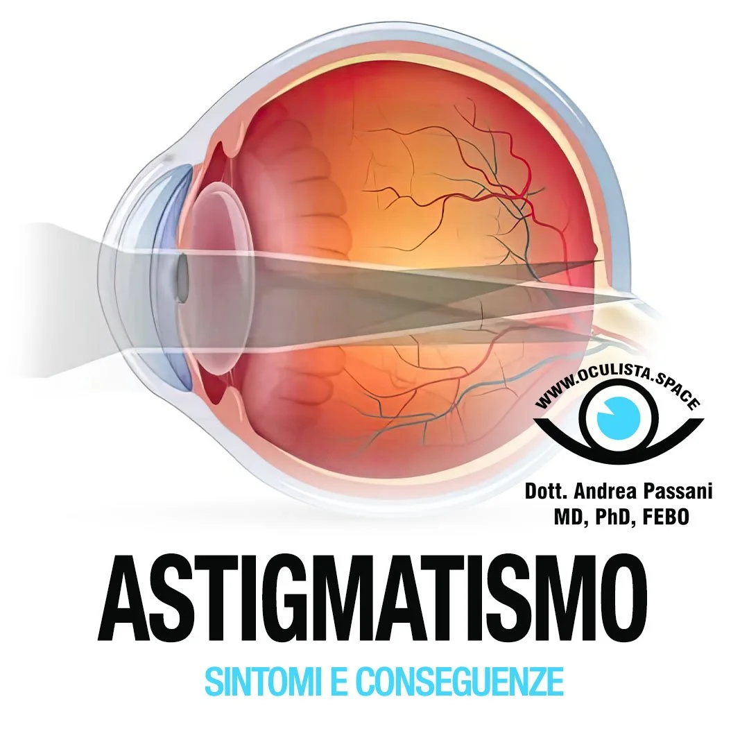 Astigmatismo: sintomi e conseguenze