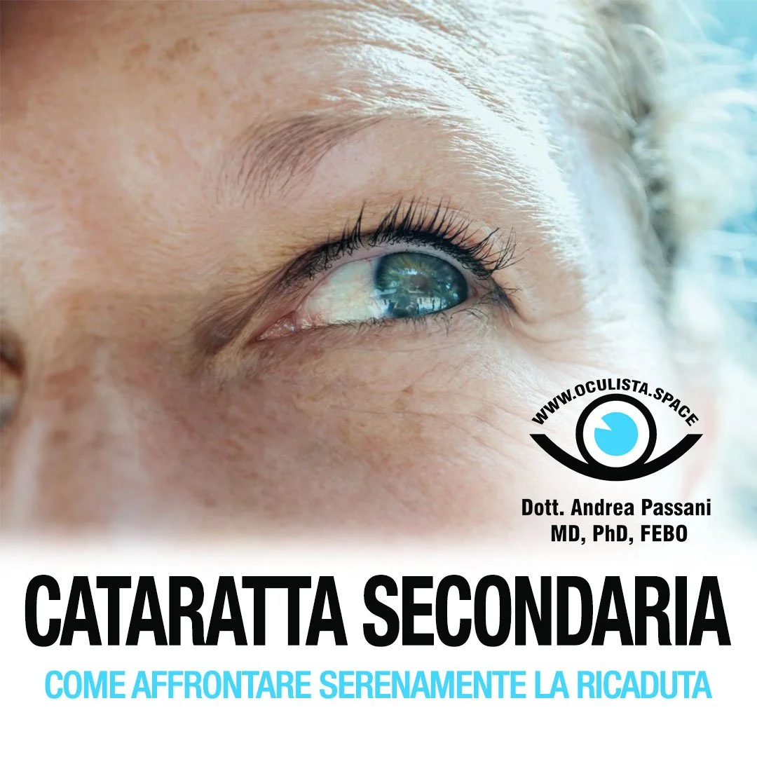 Cataratta secondaria: sintomi e trattamento