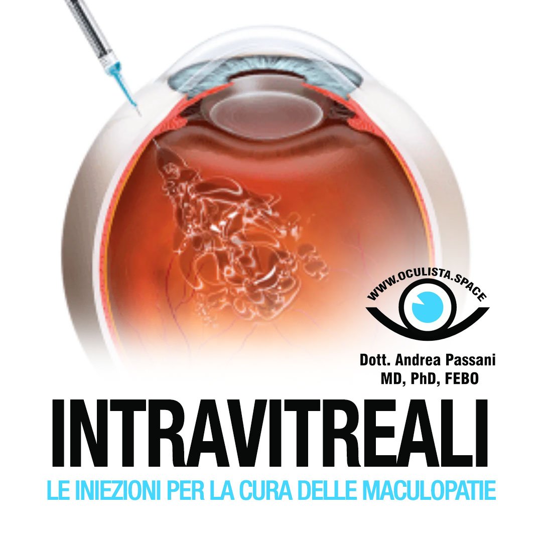 Le Iniezioni Intravitreali nella Cura delle Maculopatie