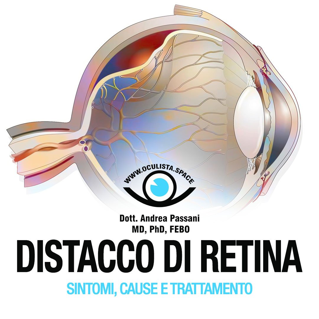 Sintomi e Cause del Distacco di retina