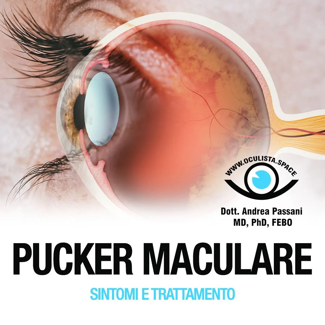 Pucker Maculare: Sintomi e Trattamento