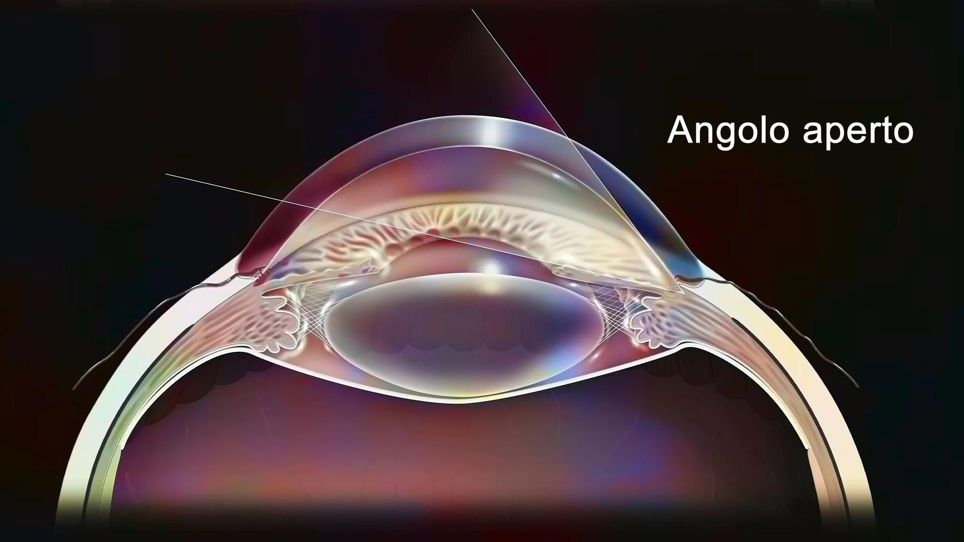 classificazione-glaucoma-terapie-anatomia-angolo-aperto