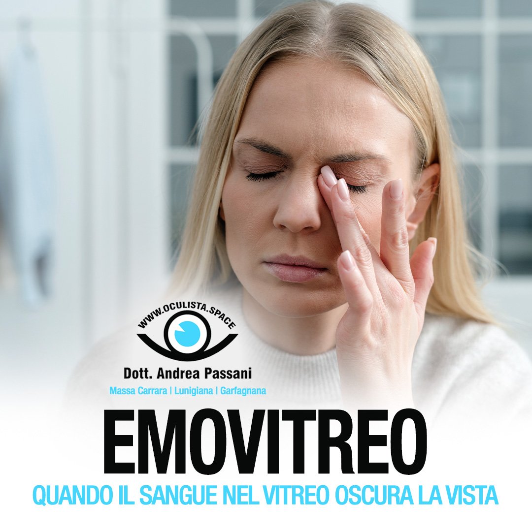 Emovitreo: quando il sangue nel vitreo oscura la vista