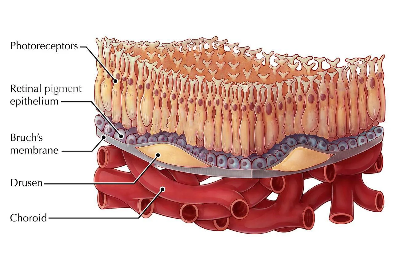 drusen-maculopatia-anatomia