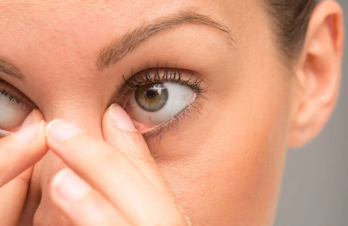 allergie-oculari-passani-prurito