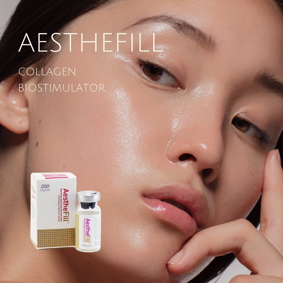 AestheFill is another type of injectable biostimulator treatment that uses Poly-D,L-lactic acid (PDLLA) microspheres to stimulate the production of collagen and improve the texture and appearance of the skin. These PDLLA microspheres are then gradual