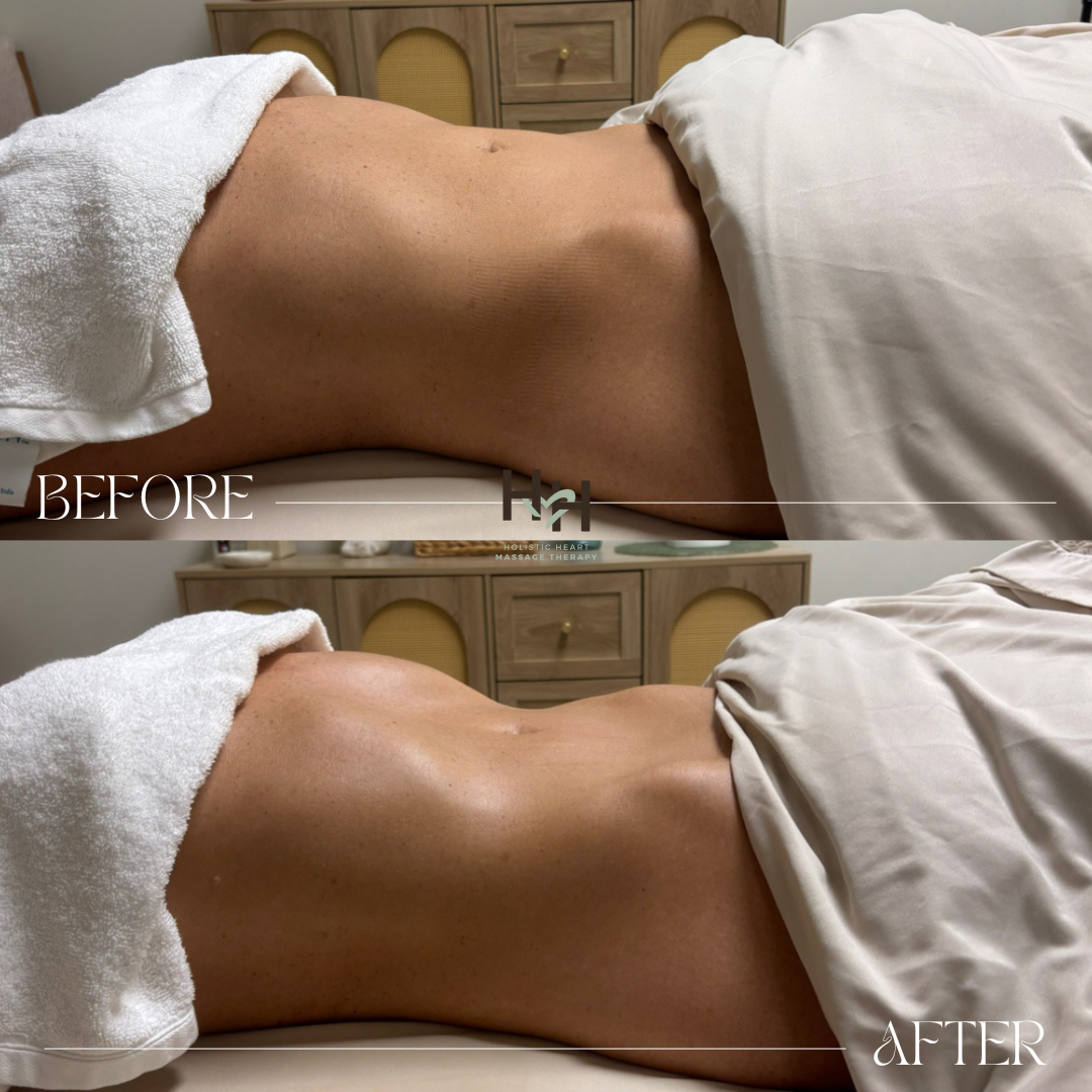 Before and after contour lymphatic drainage massage – Nashville.