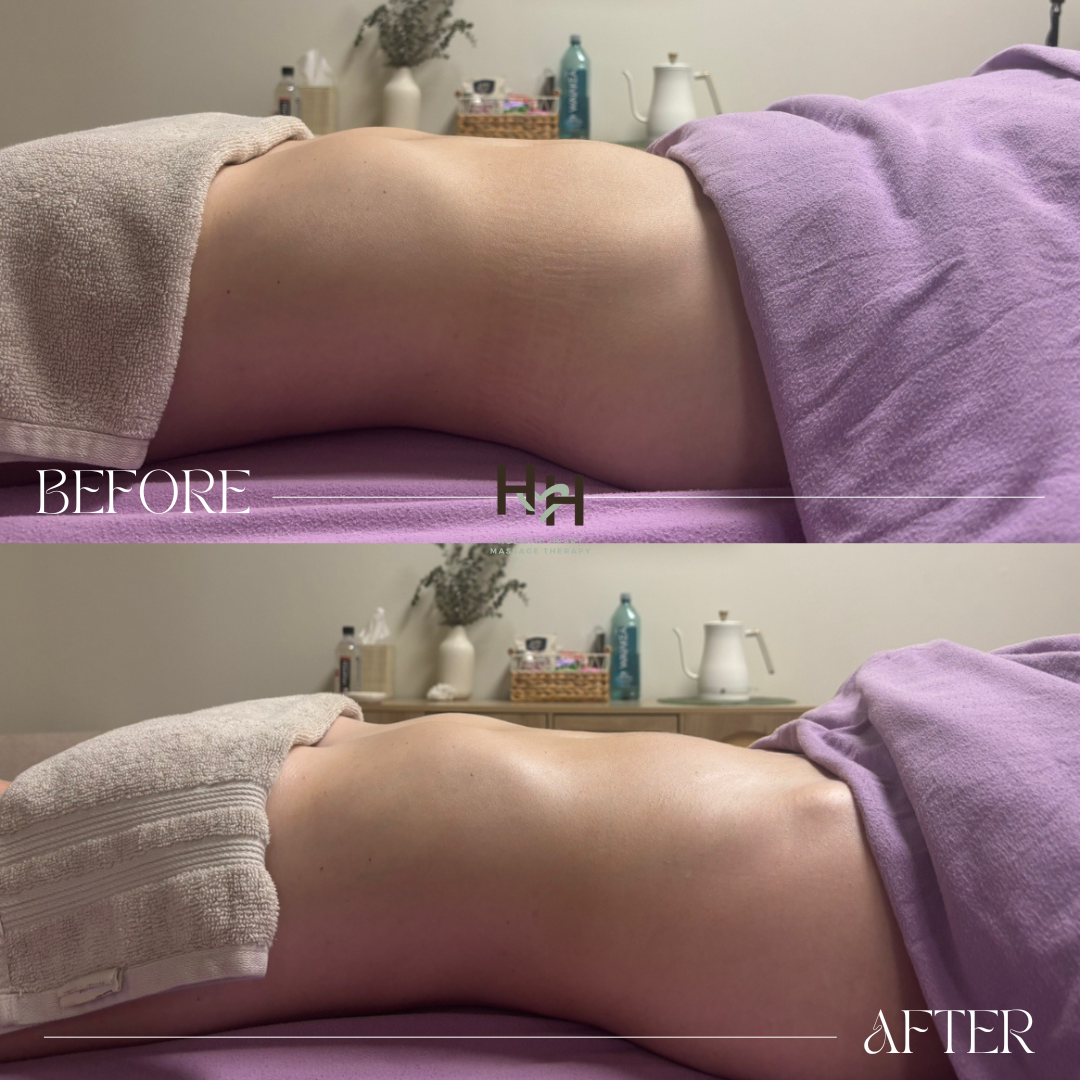 smoothing of skin after lymphatic drainage
