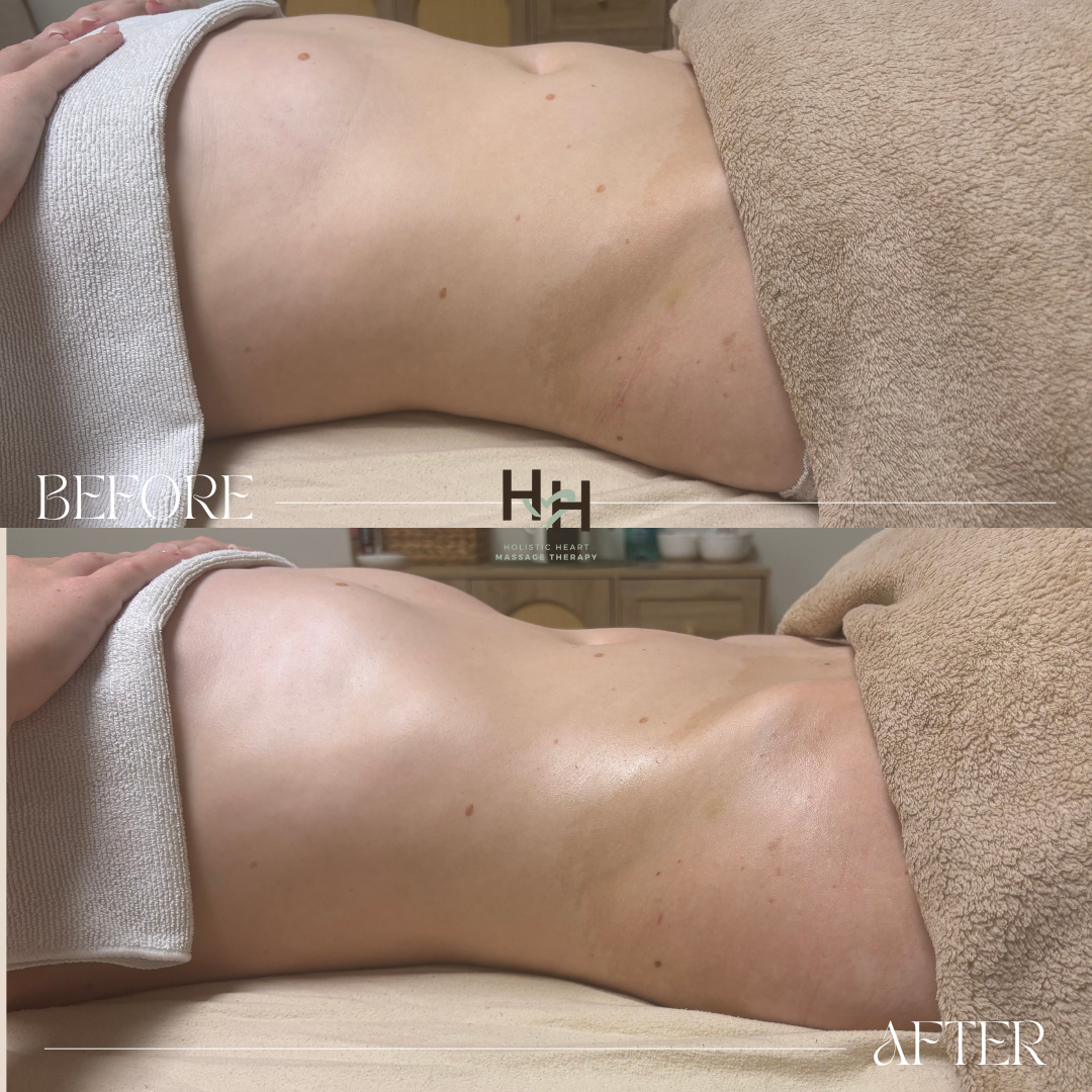 Before and after full body lymphatic drainage massage