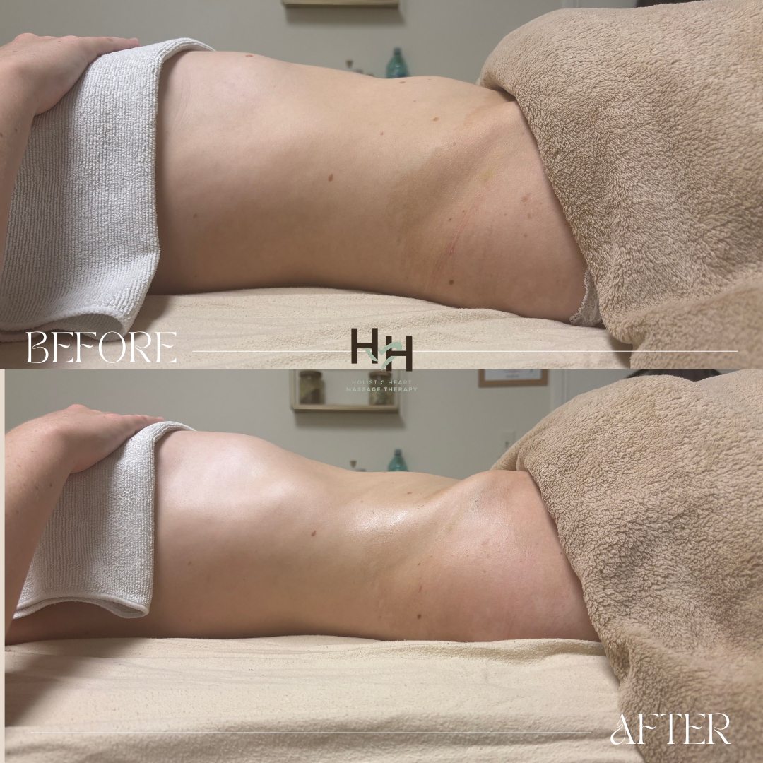lymphatic sculpting massage results