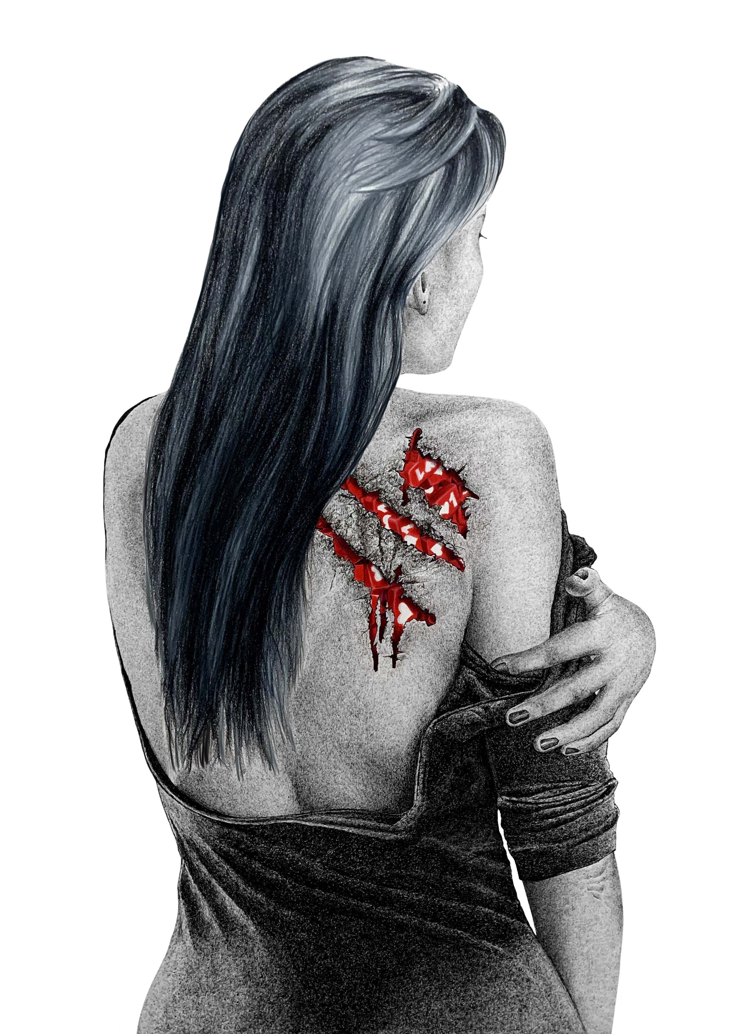 Wound #4