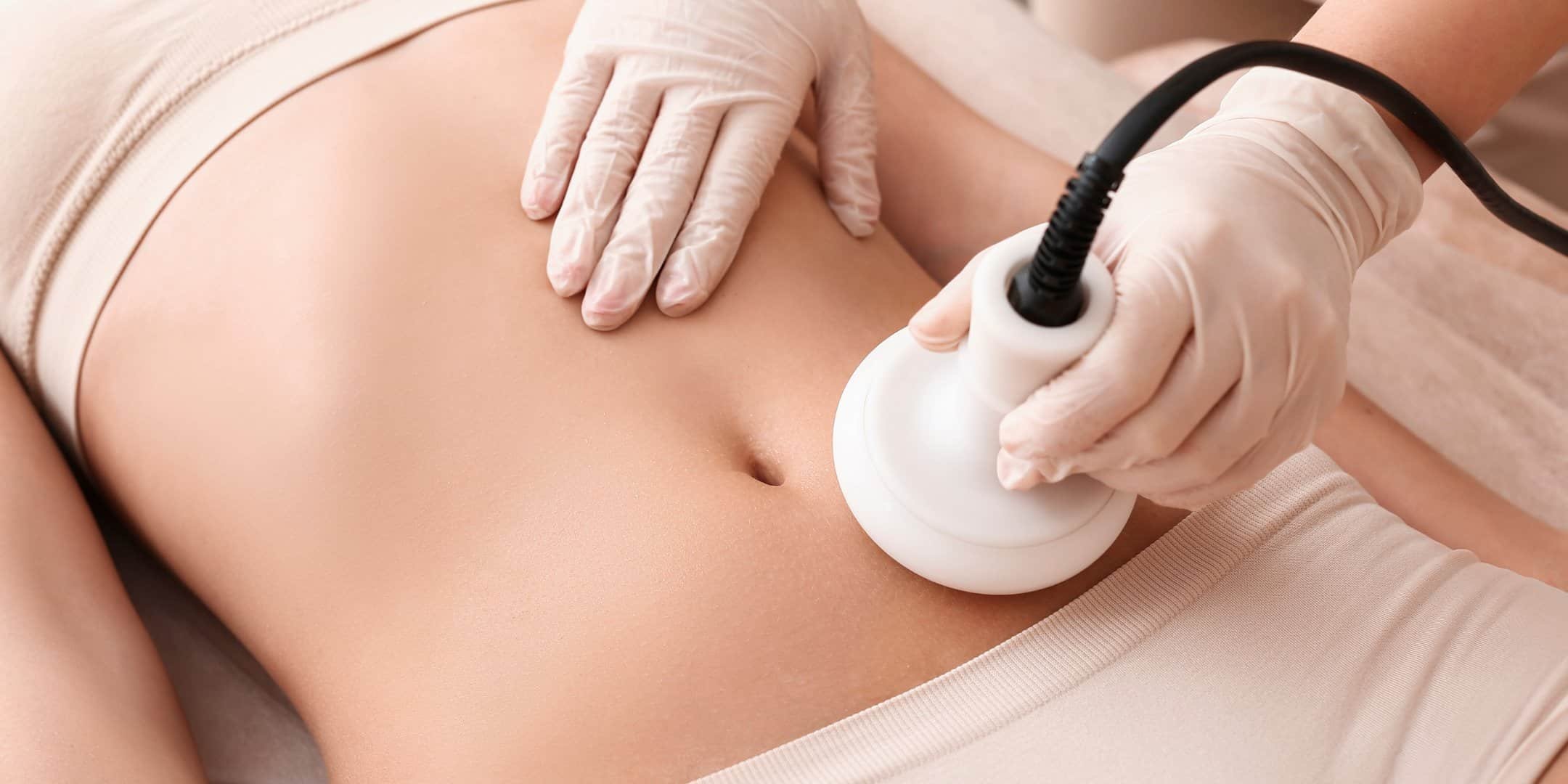 Does fat cavitation really work?
