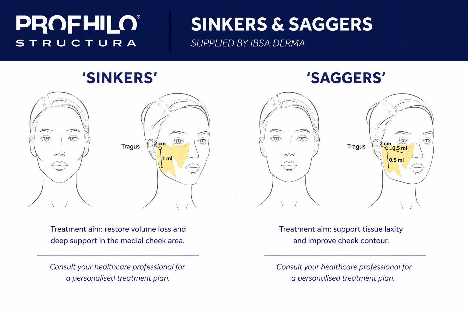 Profhilo Structura treatment diagram showing the difference between sinkers and saggers and how treatment is tailored to different facial ageing patterns.