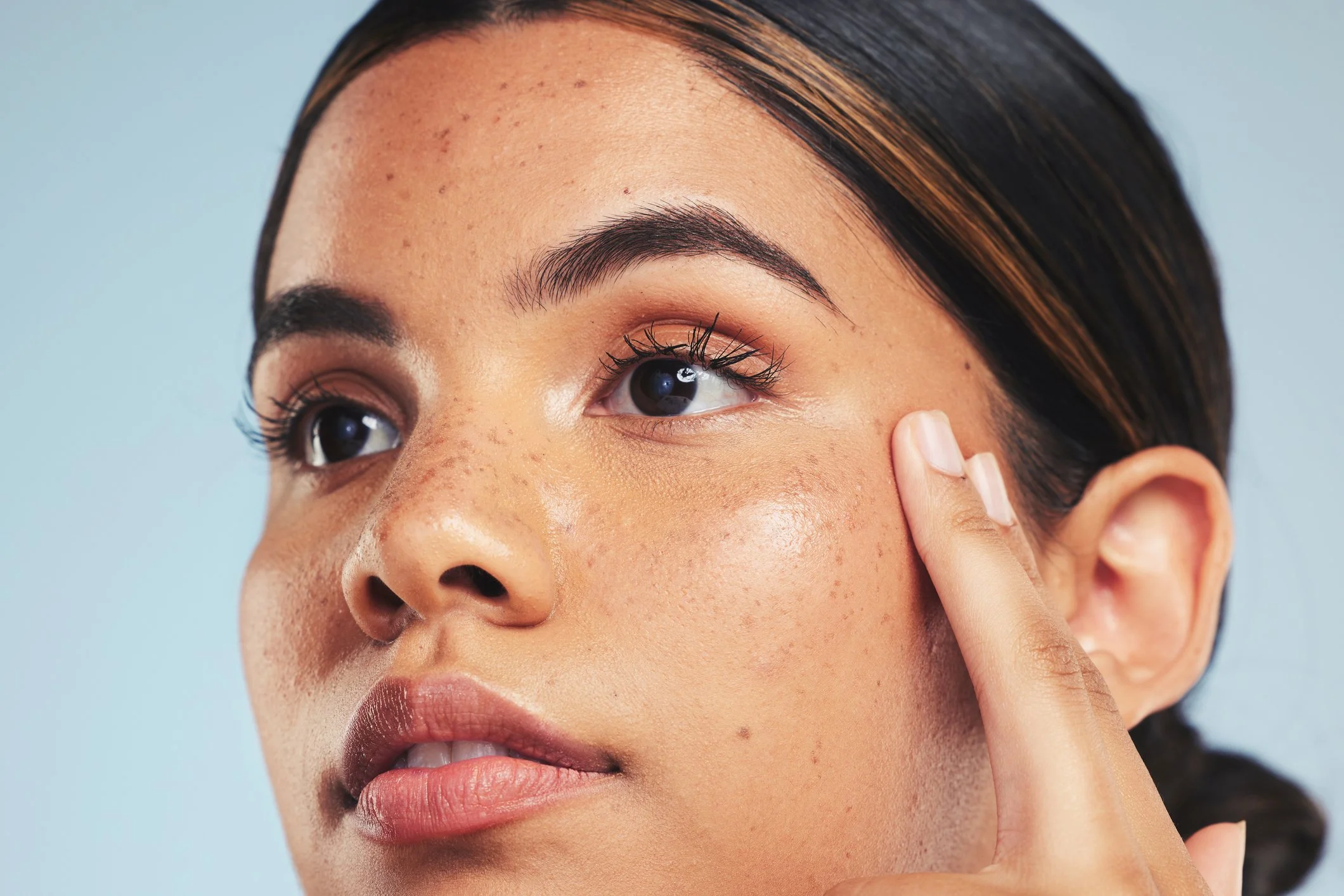 Profhilo skin remodelling treatment at Face-to-Face by Marjan in Leichhardt Sydney