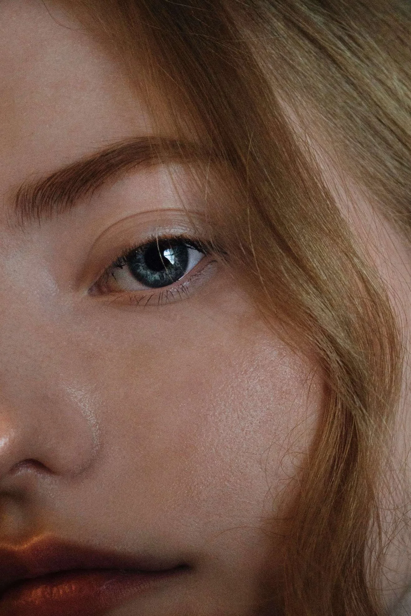 Radiesse collagen biostimulation treatment at Face-to-Face by Marjan in Leichhardt Sydney