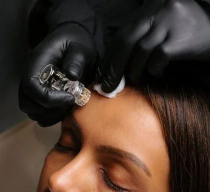 AquaGold microinfusion facial treatment being performed on the skin in Sydney