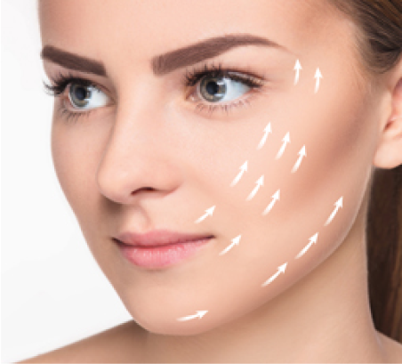 Profhilo Structura treatment for facial structure and tissue support at Face-to-Face by Marjan in Leichhardt Sydney