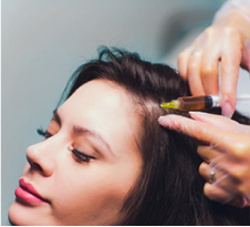 EmCyte PRP plasma therapy treatment for skin rejuvenation at Face-to-Face by Marjan in Leichhardt Sydney