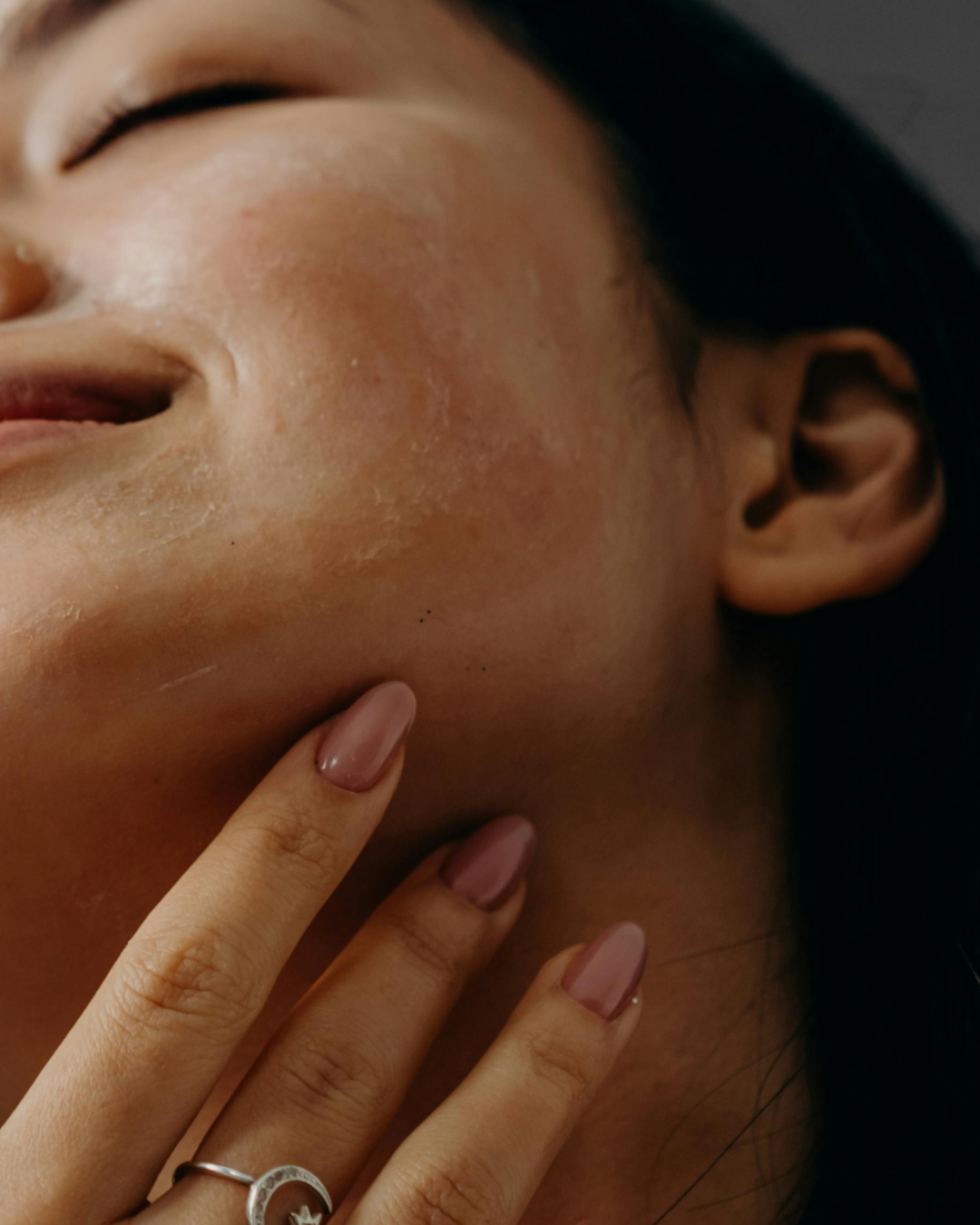 Skin Barrier Repair Ingredients Every Beauty Brand Should Focus On