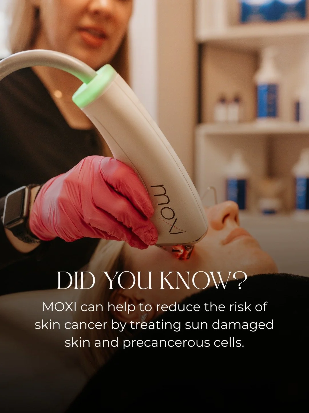 Over time, UV exposure creates damage beneath the surface that can lead to uneven pigment, rough texture, and early signs of aging. MOXI helps treat that sun-damaged skin by gently resurfacing and encouraging fresh, healthy cells to come forward 🌱

