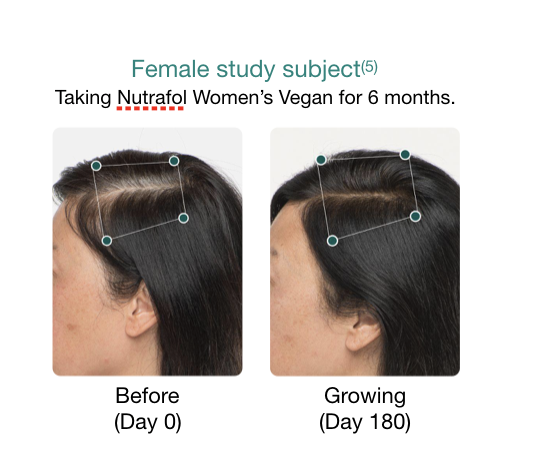 Hair thinning