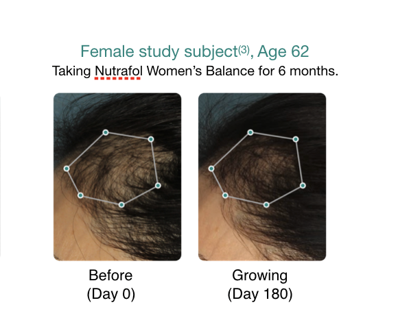 Nutrafol