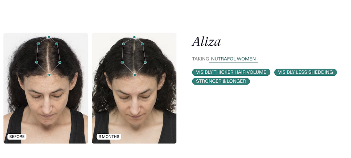 Hair thinning