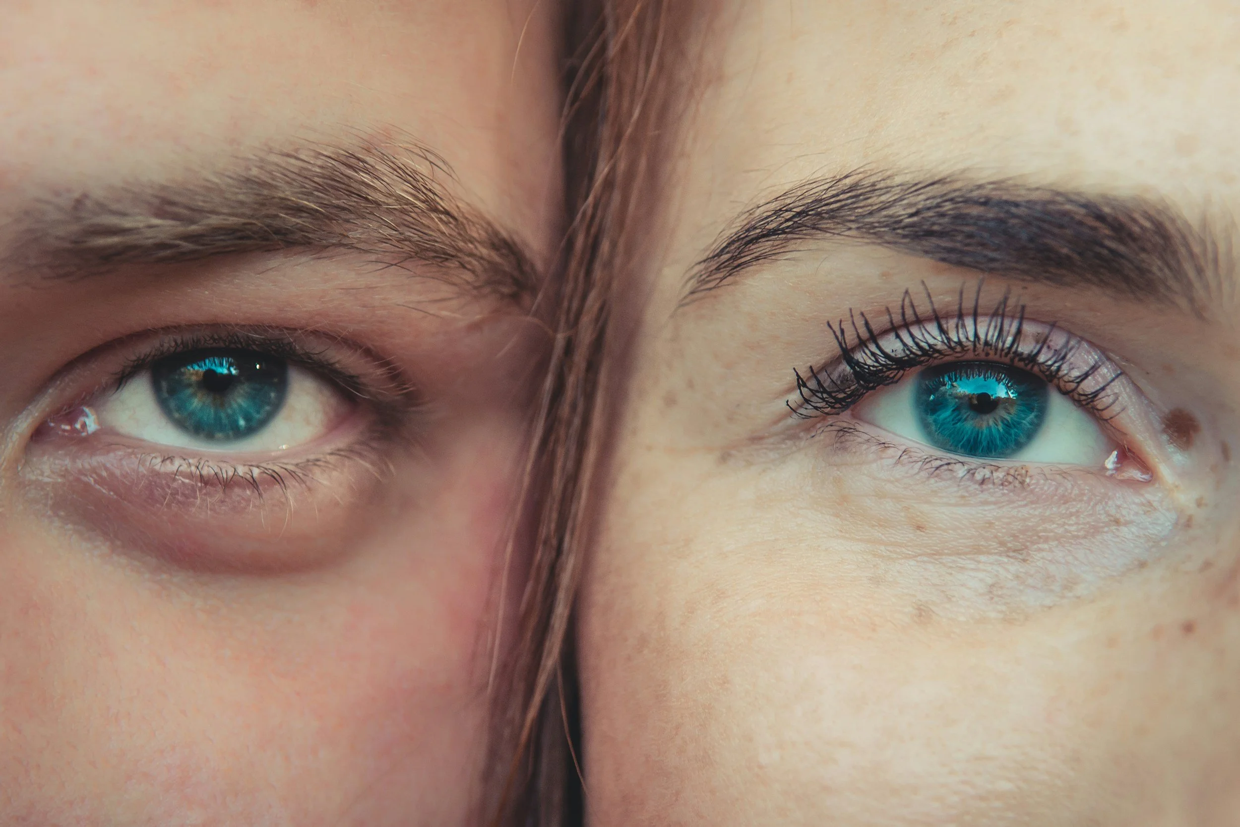 Myopie : pourquoi vos lunettes ne sont pas la seule solution ?