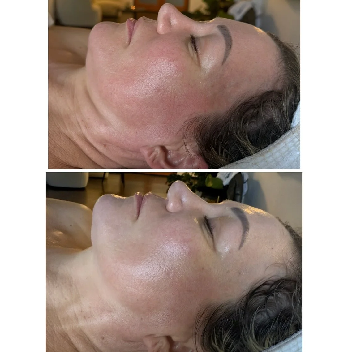 I am super excited to share this @neurotris Microcurrent before and after photo. This is after our first session out of a series. And WOW!! This lovely guest came with a goal and vision in mind and I&rsquo;m excited to see to see this transformation.