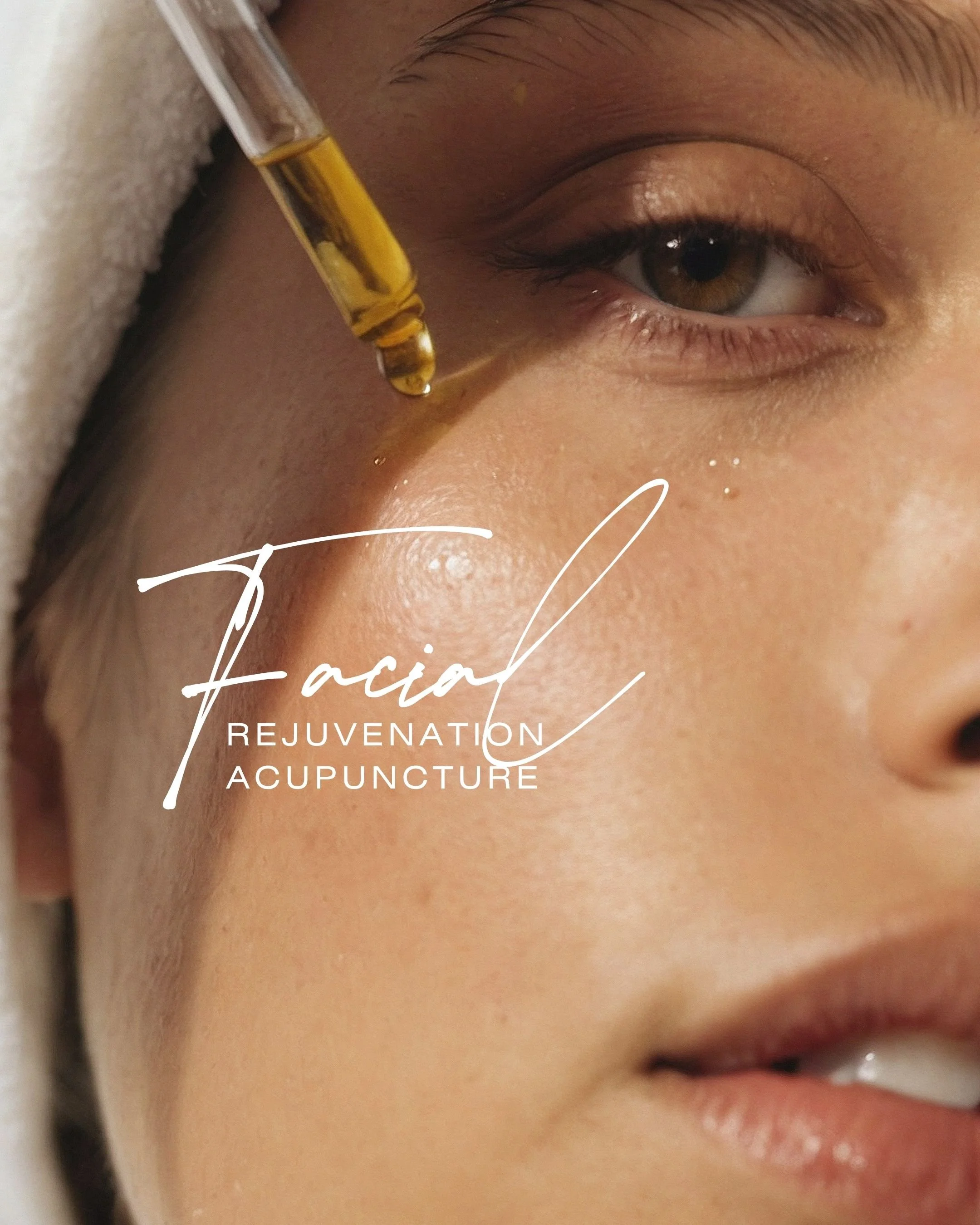 Facial Rejuvenation Acupuncture: A Gentler Path to Glowing Skin